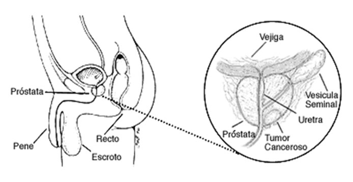 estructuraProstata